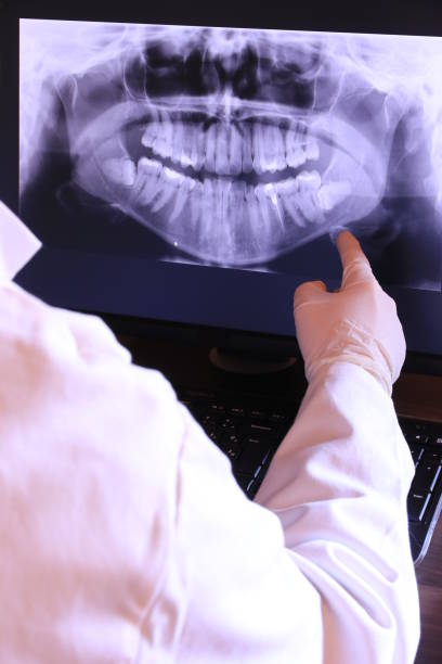 Best Urgent Dental Care for Toothache in Lexington Hills, CA