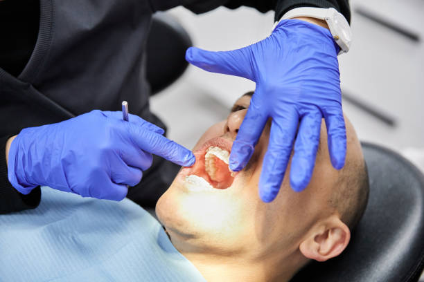 Best Holiday Emergency Dentist in Lexington Hills, CA