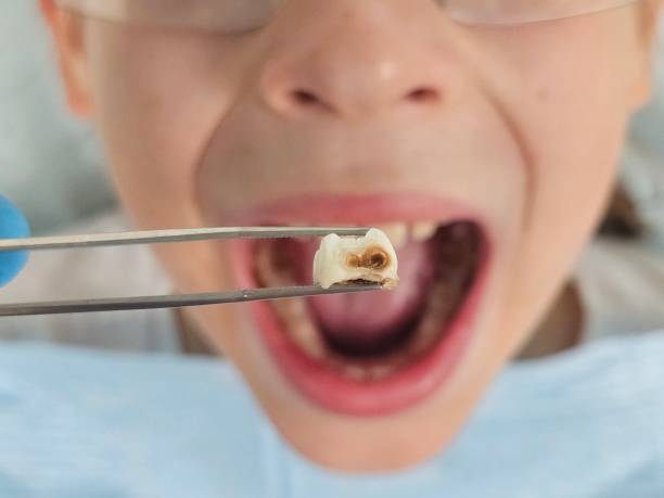 Best Emergency Dentist for Special Needs Patients in Lexington Hills, CA